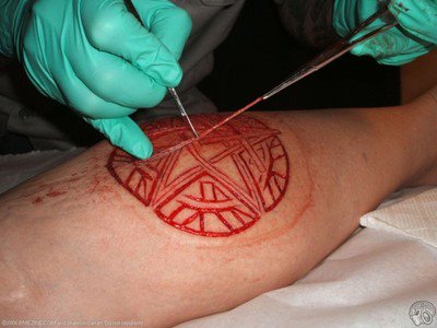 image scarification