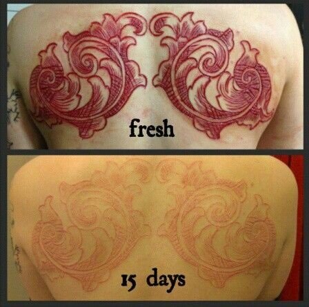 image soins scarification